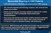 Regional Myocardial Thinning and Relationship with Myocardial Scarring in CAD Patients