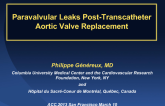 Paravalvular Leaks Post-Transcatheter Aortic Valve Replacement