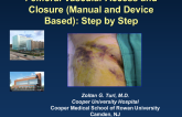 Femoral Vascular Access and Closure (Manual and Device Based): Step by Step