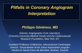 Coronary Angiography: Limitations and Artifacts