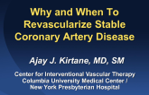 Why and When to Revascularize Stable Coronary Artery Disease