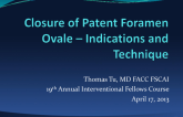 PFO Closure: Indications and technique