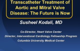 Transcatheter Aortic and Mitral Valve Replacement: The Future is Now