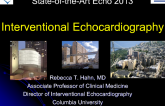 Interventional Echocardiography