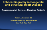 Echocardiography in Congenital and Structural Heart Disease: Assessment of Device – Repaired Patients