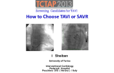 How to Choose TAVI or SAVR
