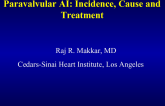 Paravalvular AI: Incidence, Cause and Treatment