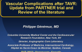 Vascular Complications: PARTNER Outcomes and Review of the Literature