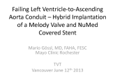 Melody Valve Implantation into an LV to Ascending Aorta Conduit with Failing Bioprosthesis