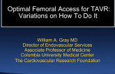 Optimal Femoral Access: Variations on How To Do It