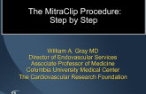 The MitraClip Procedure Step by Step