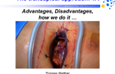 Transapical Approach: Advantages, Disadvantages, and How I Do It