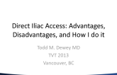 Direct Iliac Access: Advantages, Disadvantages, and How I Do It