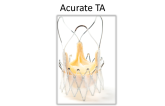 ACURATE Transapical