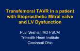 Transfemoral TAVR in a patient with Bioprosthetic Mitral valve and LV dysfunction