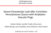 Severe Paravalvular Leak After CoreValve: Percutaneous Closure With Amplatzer Vascular Plugs