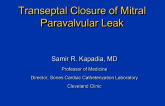 Transseptal Closure of Mitral Paravalvular Leaks (Including Case Presentations)