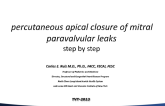 Percutaneous Apical Closure of Mitral Paravalvular Leaks (Including Case Presentations)