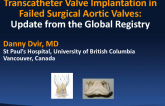 Results and Lessons from the Global TAVR Valve-in-Valve Registry