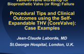 Procedural Tips and Clinical Outcomes using the Self-Expandable THV (CoreValve): Case Examples