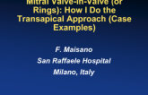 Mitral Valve-in-Valve (or Rings): How I Do the Transseptal Approach (Case Examples)