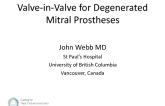 Description and Results of Valve-in-Valve for Degenerated Mitral Protheses