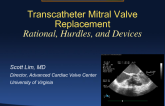 Transcatheter Mitral Valve Replacement: Rationale, Hurdles, and Devices