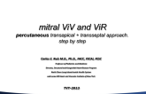 Mitral Valve-in-Valve (or Rings): How I Do the Transseptal, Transapical Approach (Case Examples)