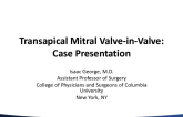 Mitral Valve-in-Valve (or Rings): How I Do the Transapical Approach