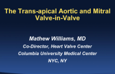 The Trans-apical Aortic and Mitral Valve-in-Valve (or ring) (Case Examples)