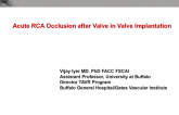 Acute RCA occlusion secondary to valve in valve deployment