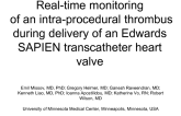 Real-time Monitoring of an Intra-procedural Thrombus During Delivery of an Edwards SAPIEN Transcatheter Heart Valve