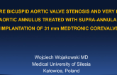 Severe bicuspid aortic valve stenosis and very large aortic annulus treated with supraannular implantation of 31mm Medtronic CoreValve