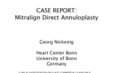 Case Report from Bonn Germany with the Mitralign Annuloplasty System