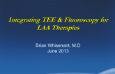 Integrating TEE and Fluoroscopy for LAA Therapies