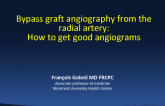 Bypass graft angiography from the radial artery: How to get good angiograms
