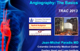 Transradial Coronary Angiography: The Basics