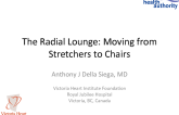 The Radial Lounge: Moving from Stretchers to Chairs