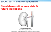 Renal Denervation: New Data & Future Indications