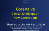 CoreValve Clinical Challenges: New Generations