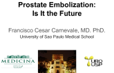 Prostate Embolization: Is It the Future?
