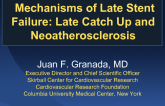Mechanisms of Late Stent Failure: Late Catch Up and Neoatherosclerosis