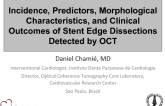 Incidence, Predictors, Morphological Characteristics, and Clinical Outcomes of Stent Edge Dissections Detected by OCT