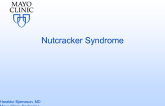 Nutcracker Syndrome