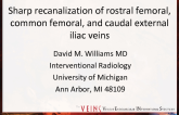 Sharp Recanalization of Rostral Femoral, Common Femoral, and Caudal External Iliac Veins