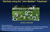 Hemodynamics and Interactive Calculations for Aortic Stenosis using the “John Madden” Telestrator