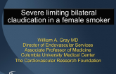 Case 1: Severe, Limiting Bilateral Claudication in a 57-Year-Old Female Previous Smoker