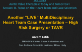 Another “LIVE” Multi-Disciplinary Heart Team Case Presentation – High Risk Surgery or AVR