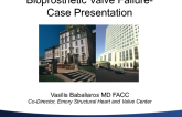 Bioprosthetic Valve Failure - Case presentation