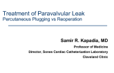 Treatment of Paravalvular Leak: Percutaneous Plugging vs. Reoperation